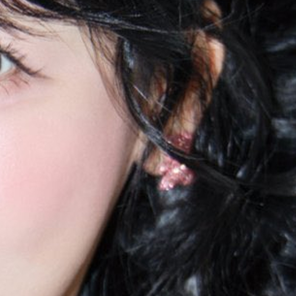 Recent activity shot of Choerry (ARTMS)