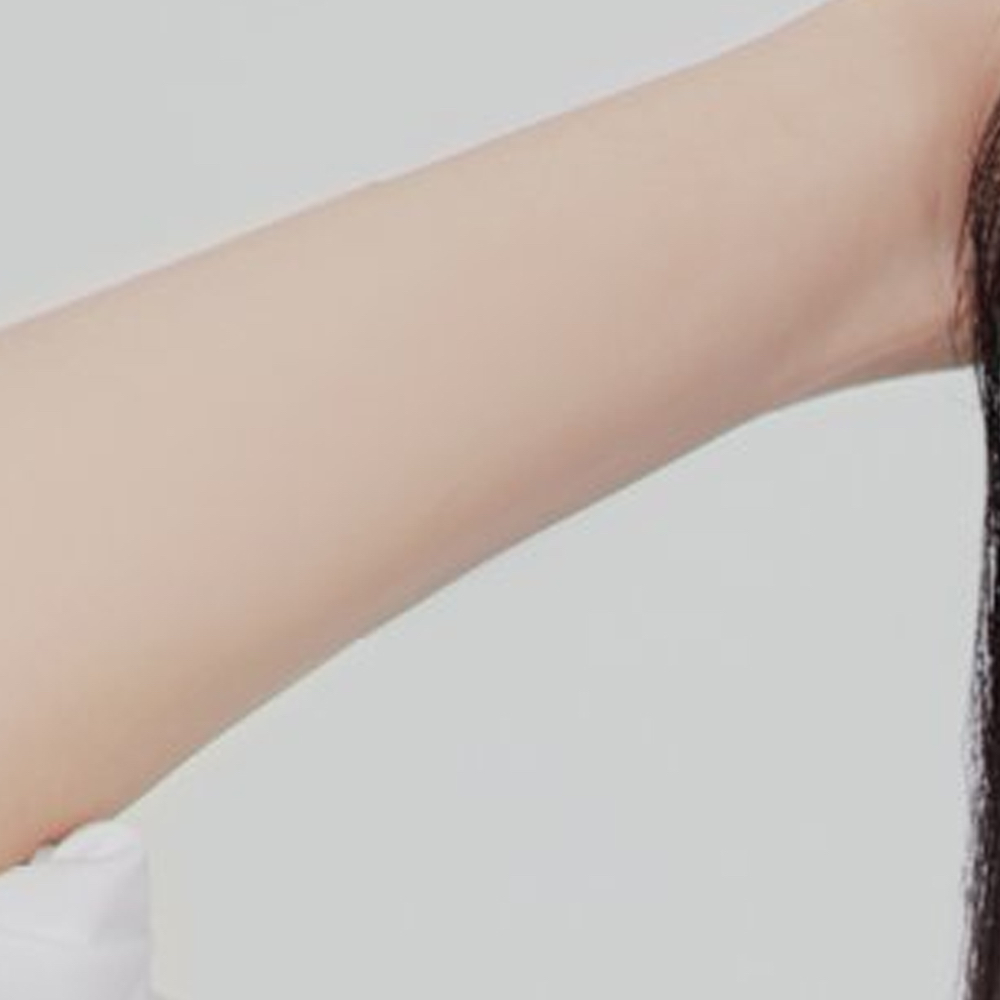 Recent activity shot of Choerry (ARTMS)