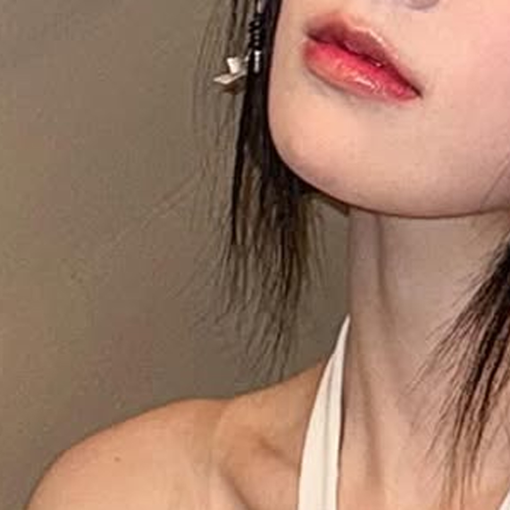 Recent activity shot of Choerry (ARTMS)
