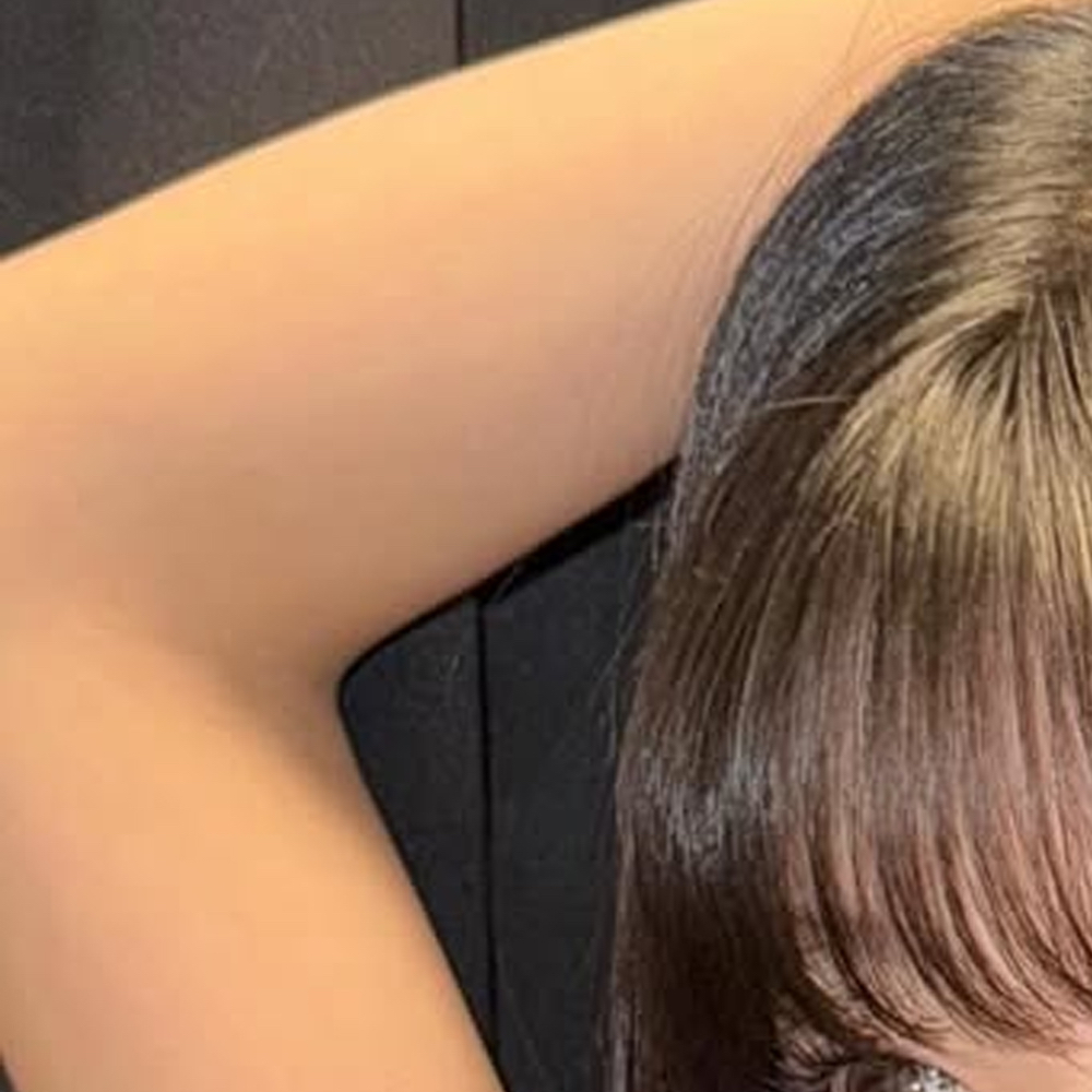 Recent activity shot of Choerry (ARTMS)