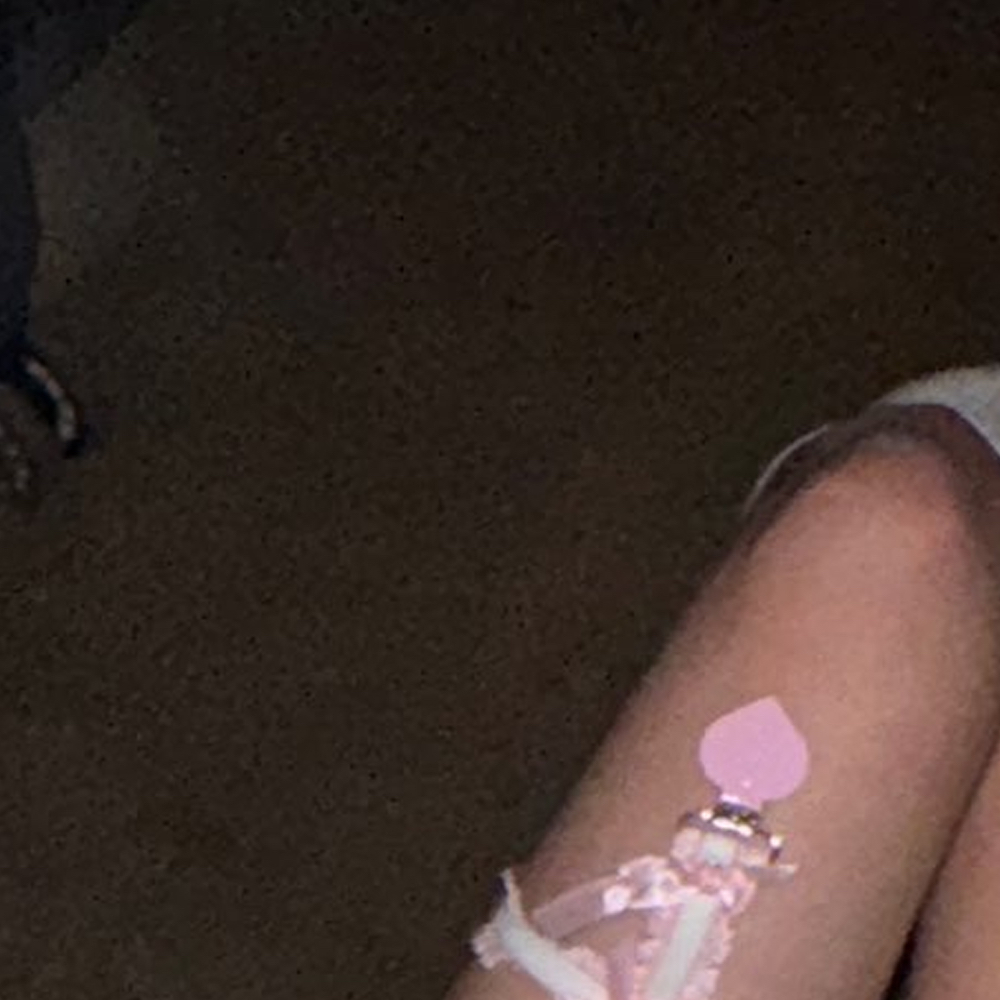 Choerry (ARTMS)的幕后花絮