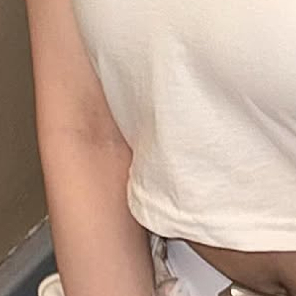 Recent activity shot of Choerry (ARTMS)
