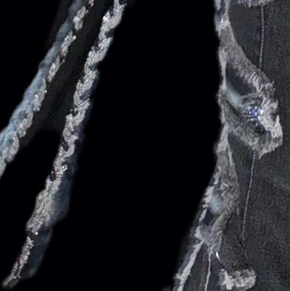 Behind-the-scenes cut of Choerry (ARTMS)